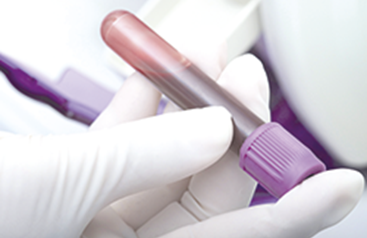 Blood test image